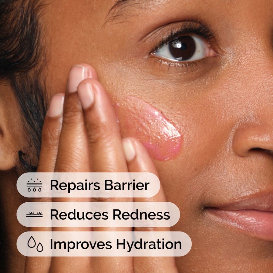 Application of Soothing and Barrier Support Serum